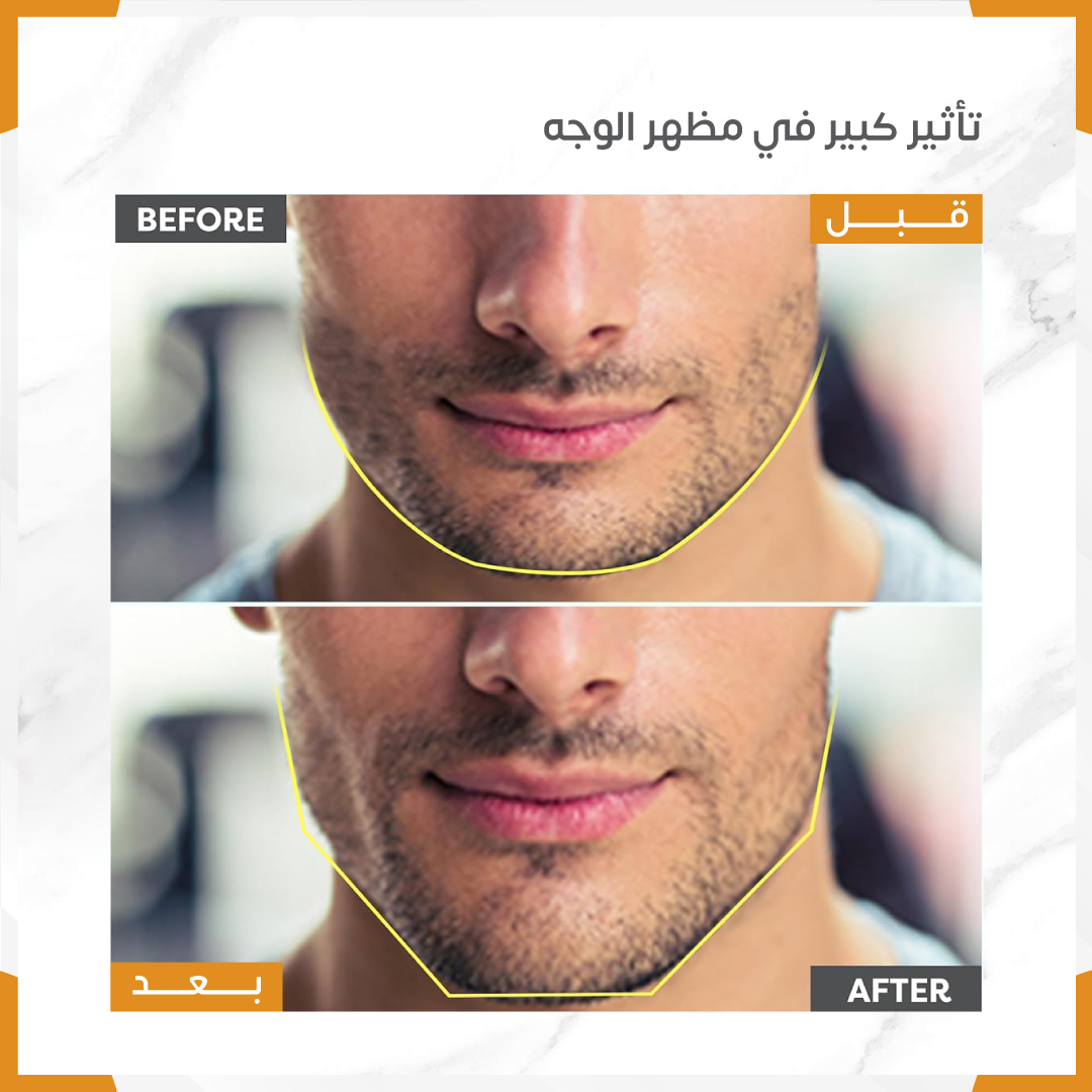 مجموعة مدرب الفك